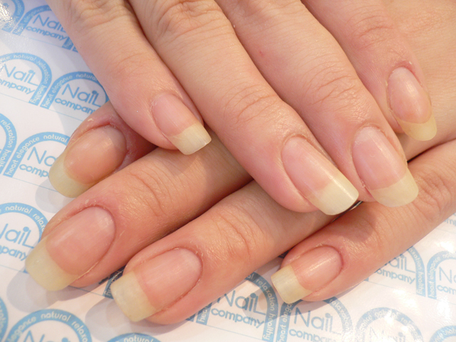 爪を噛む いじるなど 爪にお悩みのある方2 札幌ネイルサロン 健康グラスネイル ネイルカンパニー