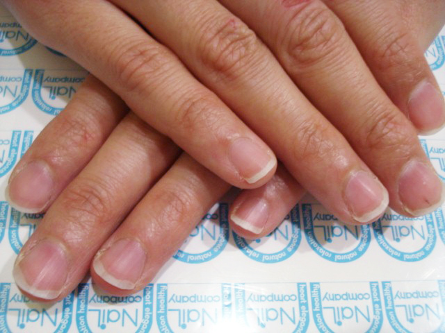 ネイルベットが短い爪施工前