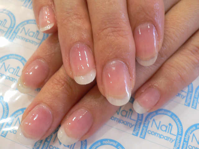 ネイルベットが短い爪施工後