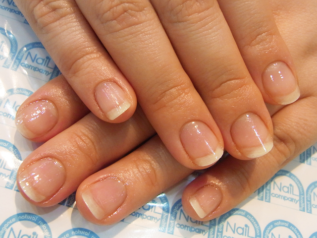 ささくれ1施工後