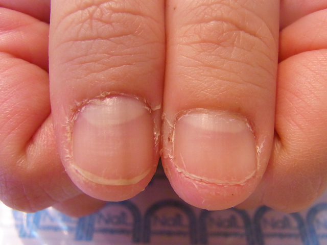 ささくれ2施工前