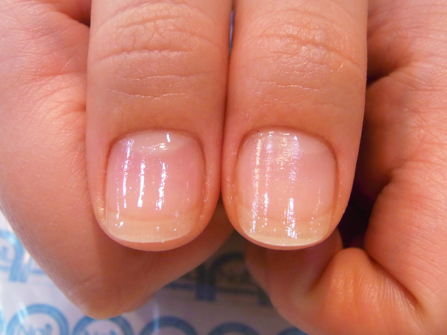 ささくれ2施工後