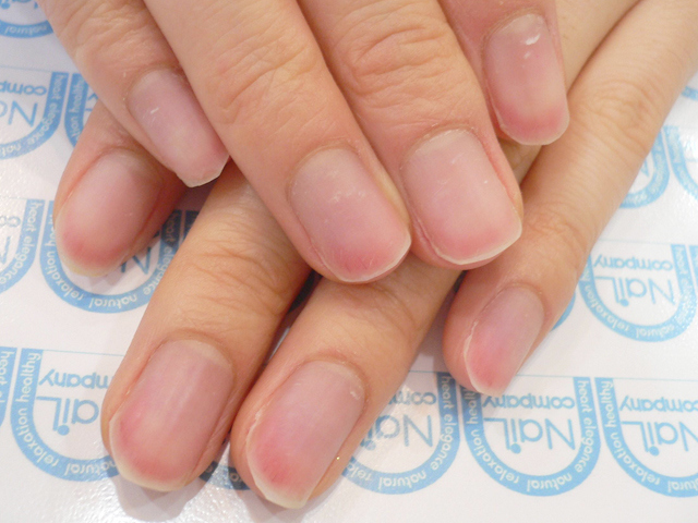 薄い爪１施工前