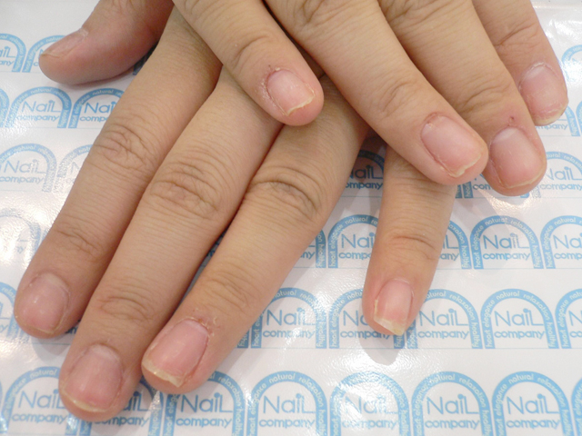 割れる爪2施工前